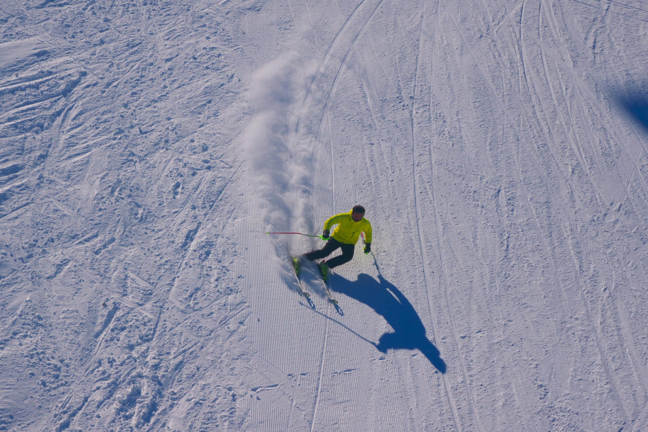 A person wearing a bright yellow jacket skis downhill on a snowy slope, plus drive stress melts away as the cold mountain air thickens blood, leaving a trail of snow behind them. Mobile IV for post-ski recovery helps replenish fluids and electrolytes after Whistler-Vancouver trips.